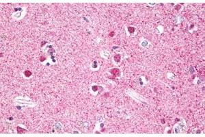 Anti-RPS6KA5 / MSK1 antibody IHC staining of human brain, cortex neurons. (MSK1 antibody  (AA 551-600))
