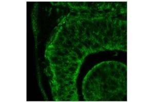 Itgb1 antibody used at a dilution of 1:500 to detect human eye (day 24). (ITGB1 antibody  (C-Term))