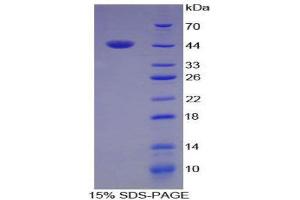SDS-PAGE (SDS) image for Angiogenin (ANG) (AA 25-145) protein (His tag,GST tag) (ABIN1880029) (ANG Protein (AA 25-145) (His tag,GST tag))