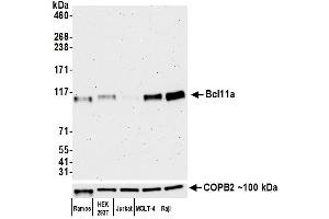 Western Blotting (WB) image for anti-B-Cell CLL/lymphoma 11A (Zinc Finger Protein) (BCL11A) (AA 785-835) antibody (ABIN7452847) (Recombinant BCL11A antibody  (AA 785-835))