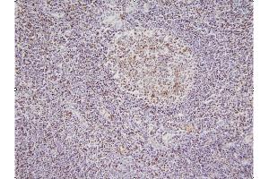 This image shows paraffin-embedded human palatine tonsil tissue sample stained with anti-NPM antibody (5E3) at 1:100 dilution. (NPM1 antibody)
