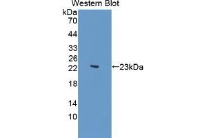 Detection of Recombinant KDM4A, Human using Polyclonal Antibody to Lysine Specific Demethylase 4A (KDM4A) (KDM4A antibody  (AA 141-310))