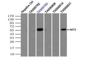 Image no. 3 for anti-V-Akt Murine Thymoma Viral Oncogene Homolog 2 (AKT2) antibody (ABIN1496565)