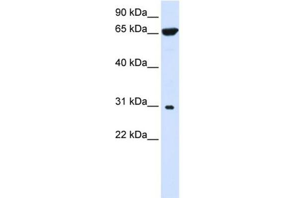 PTPLAD2 antibody  (Middle Region)