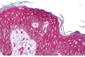 Anti-RET antibody IHC staining of human skin. (Ret Proto-Oncogene antibody  (AA 152-182))