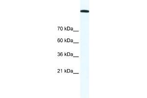 WB Suggested Anti-TOP2A Antibody Titration:  1. (Topoisomerase II alpha antibody  (C-Term))