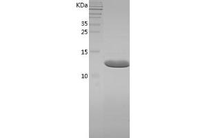 Western Blotting (WB) image for Fatty Acid Binding Protein 6, Ileal (FABP6) (AA 2-128) protein (His tag) (ABIN7281644) (FABP6 Protein (AA 2-128) (His tag))