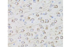 Immunohistochemistry of paraffin-embedded Mouse brain using MIP Polyclonal Antibody at dilution of 1:100 (40x lens). (Mip antibody)