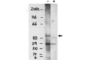 Image no. 1 for anti-Sphingosine-1-Phosphate Receptor 4 (S1PR4) (C-Term) antibody (ABIN265012) (S1PR4 antibody  (C-Term))