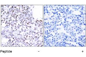 Image no. 1 for anti-Structural Maintenance of Chromosomes 1A (SMC1A) (Ser957) antibody (ABIN197408) (SMC1A antibody  (Ser957))