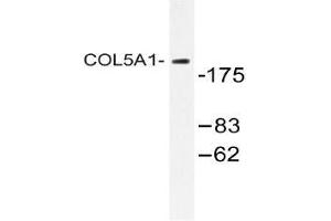 Western blot (WB) analysis of COL5A1 antibody in extracts from HeLa cells. (Collagen Type V antibody)
