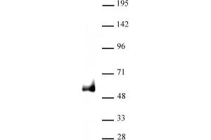 PAX6 antibody (pAb) tested by Western blot. (PAX6 antibody  (C-Term))