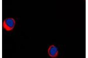 Immunofluorescent analysis of ARRDC1 staining in MDAMB231 cells. (ARRDC1 antibody  (Center))