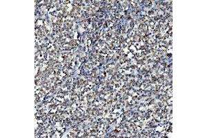 IHC analysis of DDX1 using anti-DDX1 antibody (ABIN7602051). (DDX1 antibody  (AA 562-740))