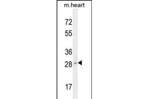 LIX1 Antibody (C-term) (ABIN654749 and ABIN2844431) western blot analysis in mouse heart tissue lysates (35 μg/lane). (LIX1 antibody  (C-Term))