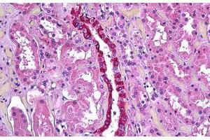 Human Kidney, Renal Duct: Formalin-Fixed, Paraffin-Embedded (FFPE) (TGFBI antibody  (AA 119-131))