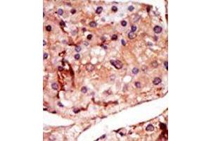 Image no. 1 for anti-6-phosphofructo-2-Kinase/fructose-2,6-Biphosphatase 2 (PFKFB2) (N-Term) antibody (ABIN360654) (PFKFB2 antibody  (N-Term))