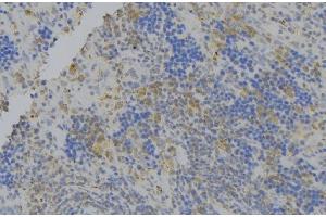 ABIN6276400 at 1/100 staining Human lymph node tissue by IHC-P. (ATG7 antibody  (N-Term))