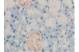 Detection of BCKDK in Rat Pancreas Tissue using Polyclonal Antibody to Branched Chain Alpha-Ketoacid Dehydrogenase Kinase (BCKDK) (BCKDK antibody  (AA 44-223))