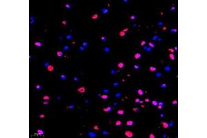Immunofluorescence of paraffin embedded rat epencephalon using TYW1B (ABIN7076025) at dilution of 1: 650 (400x lens)