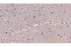 Detection of RELN in Human Cerebrum Tissue using Monoclonal Antibody to Reelin (RELN) (Reelin antibody  (AA 26-190))