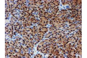 Image no. 6 for anti-Phosphoglucomutase 3 (PGM3) antibody (ABIN1500178)