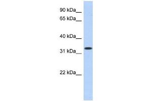 MPPED2 antibody used at 1 ug/ml to detect target protein.