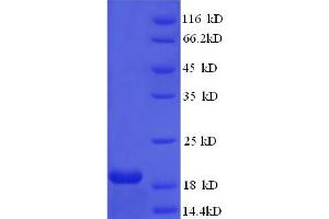 SDS-PAGE (SDS) image for Human Papilloma Virus 16 E7 (HPV-16 E7) (AA 1-105), (full length) protein (His tag) (ABIN5711077) (HPV16 E7 Protein (AA 1-105, full length) (His tag))