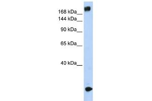 WB Suggested Anti-SCN5A Antibody Titration:  0. (SCN5A antibody  (N-Term))