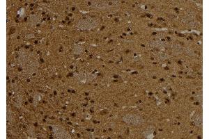 ABIN6276787 at 1/100 staining Rat brain tissue by IHC-P. (CTNND1 antibody)