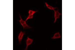 ABIN6266850 staining A549 by IF/ICC. (ADCK1 antibody  (Internal Region))