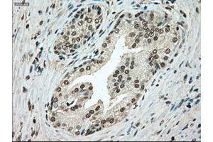 Image no. 4 for anti-TYRO3 Protein Tyrosine Kinase (TYRO3) antibody (ABIN1501608)