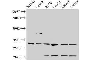 Western Blot Positive WB detected in: Jurkat whole cell lysate, HepG2 whole cell lysate, HL60 whole cell lysate, Rat brain tissue, Rat kidney tissue, Mouse kidney tissue All lanes: YWHAB antibody at 4 μg/mL Secondary Goat polyclonal to rabbit IgG at 1/50000 dilution Predicted band size: 29, 28 kDa Observed band size: 29 kDa (YWHAB antibody  (AA 1-246))