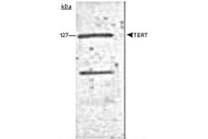 Western blot analysis of human TERT using TERT monoclonal antibody, clone 2D8 .