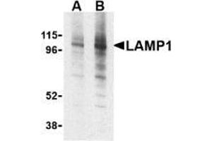 AP20059PU-N CD107a/LAMP1 antibody staining of EL4 cell lysate by Western Blotting at (A) 1 and (B) 2 μg/ml. (LAMP1 antibody)
