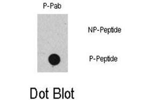 Dot blot analysis of RAF1 (phospho S471) polyclonal antibody  on nitrocellulose membrane.