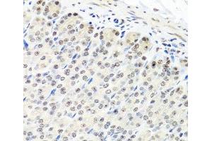 Immunohistochemistry of paraffin-embedded Mouse stomach using CNOT8 Polyclonal Antibody at dilution of 1:100 (40x lens). (CNOT8 antibody)