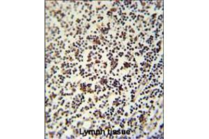LSP1 Antibody immunohistochemistry analysis in formalin fixed and paraffin embedded human lymph tissue followed by peroxidase conjugation of the secondary antibody and DAB staining. (LSP1 antibody  (AA 108-134))