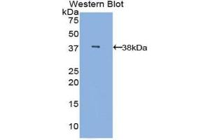 Western Blotting (WB) image for anti-Mannose-Binding Lectin (Protein C) 2, Soluble (MBL2) (AA 42-96) antibody (ABIN3206582) (MBL2 antibody  (AA 42-96))