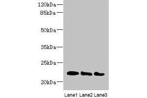 Western blot All lanes: ARL8B antibody at 4 μg/mL Lane 1: Mouse brain tissue Lane 2: NIH/3T3 whole cell lysate Lane 3: Jurkat whole cell lysate Secondary Goat polyclonal to rabbit IgG at 1/10000 dilution Predicted band size: 22, 19 kDa Observed band size: 22 kDa (ARL8B antibody  (AA 20-186))