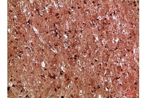 Immunohistochemical analysis of paraffin-embedded Human-brain, antibody was diluted at 1:100 (IL17D antibody  (AA 141-190))