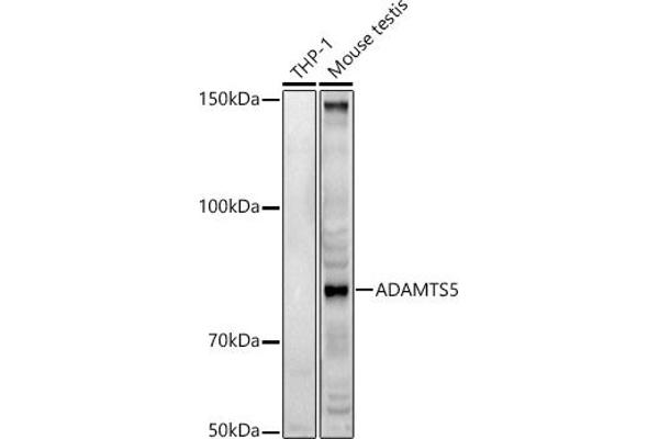 ADAMTS5 antibody  (AA 731-930)
