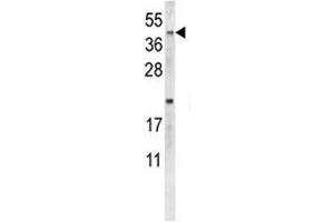 Western blot analysis of NEU1 antibody and MDA-MB231 lysate. (NEU1 antibody  (AA 11-40))