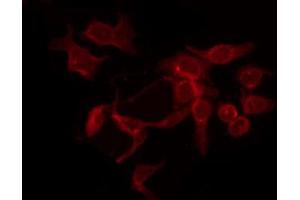 ABIN6267492 staining K562 by IF/ICC.