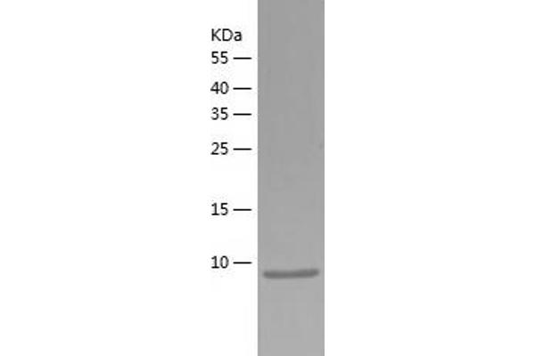 CXCL14 Protein (AA 23-99) (His tag)