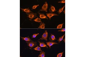 Immunofluorescence analysis of L929 cells using ZCCHC11 Rabbit pAb (ABIN6128939, ABIN6150406, ABIN6150407 and ABIN6221650) at dilution of 1:100.