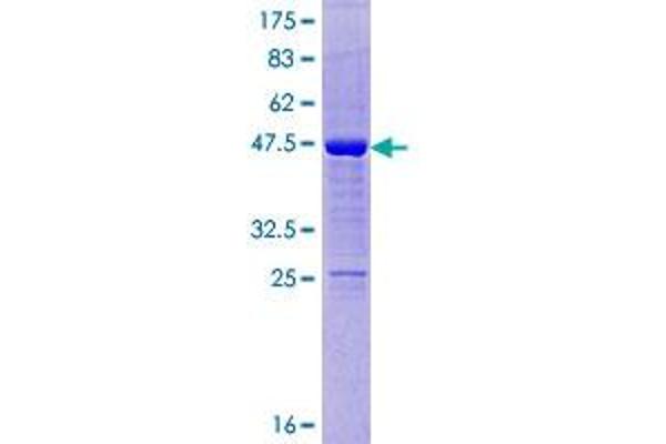 ODAM Protein (AA 1-153) (GST tag)