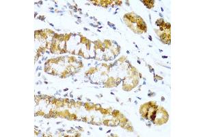 Immunohistochemistry of paraffin-embedded human stomach using GCG antibody (ABIN5970469) at dilution of 1/100 (40x lens). (Glucagon antibody)