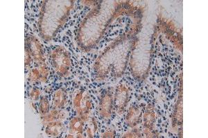 Used in DAB staining on fromalin fixed paraffin- embedded stomach tissue (Keratin 3 antibody  (AA 198-514))
