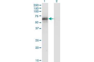 Western Blot analysis of BIN1 expression in transfected 293T cell line by BIN1 monoclonal antibody (M03), clone 2C7.